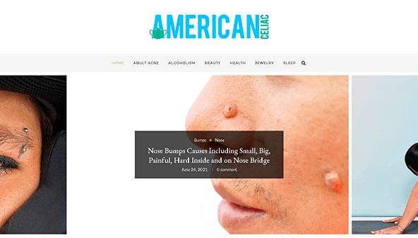Amerikai cöliákia (americanceliac.org)